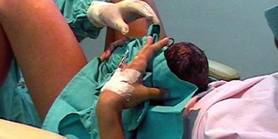 Parto Natural contra Parto Medicalizado