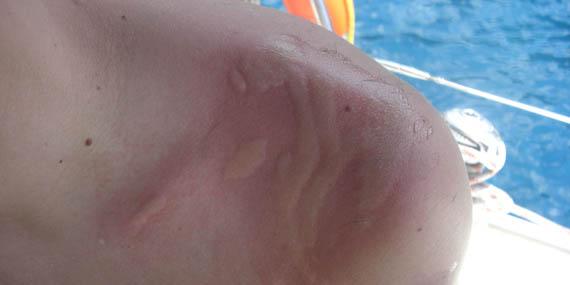 130717 plaga medusas mediterraneo