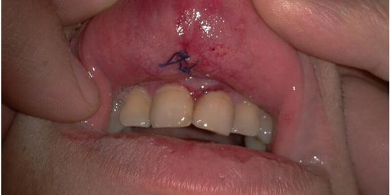 130216 boca funcionario navalcarnero