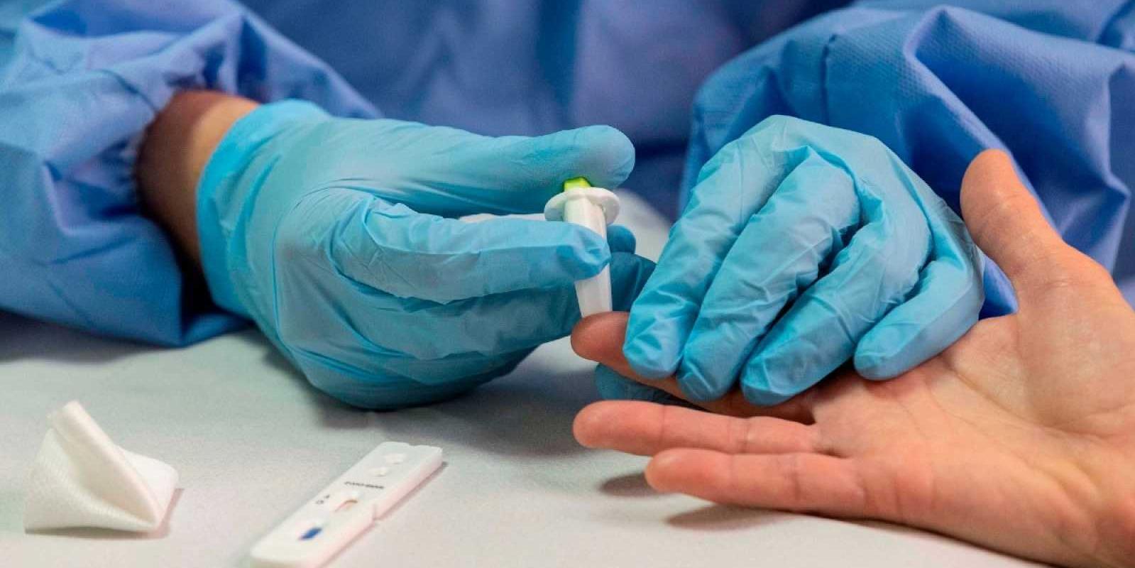 El alcalde de Galapagar solicita información a la Comunidad para la realización masiva de test