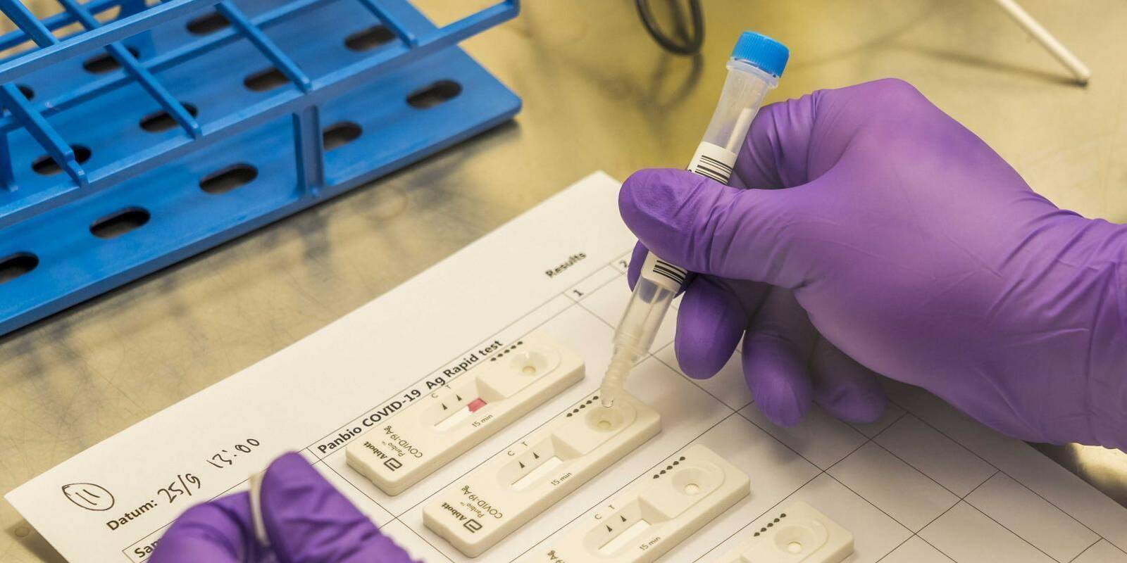 Detectado un 1,3% de positivos asintómaticos en los 24.000 test de antígenos realizados a los vecinos de Villalba