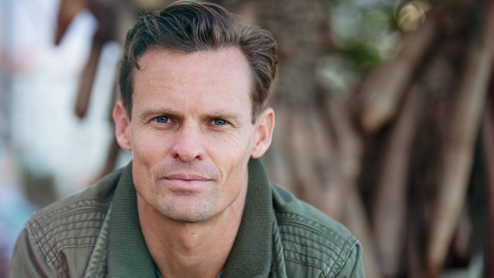 Tres de los mejores doctores de injerto capilar en Madrid