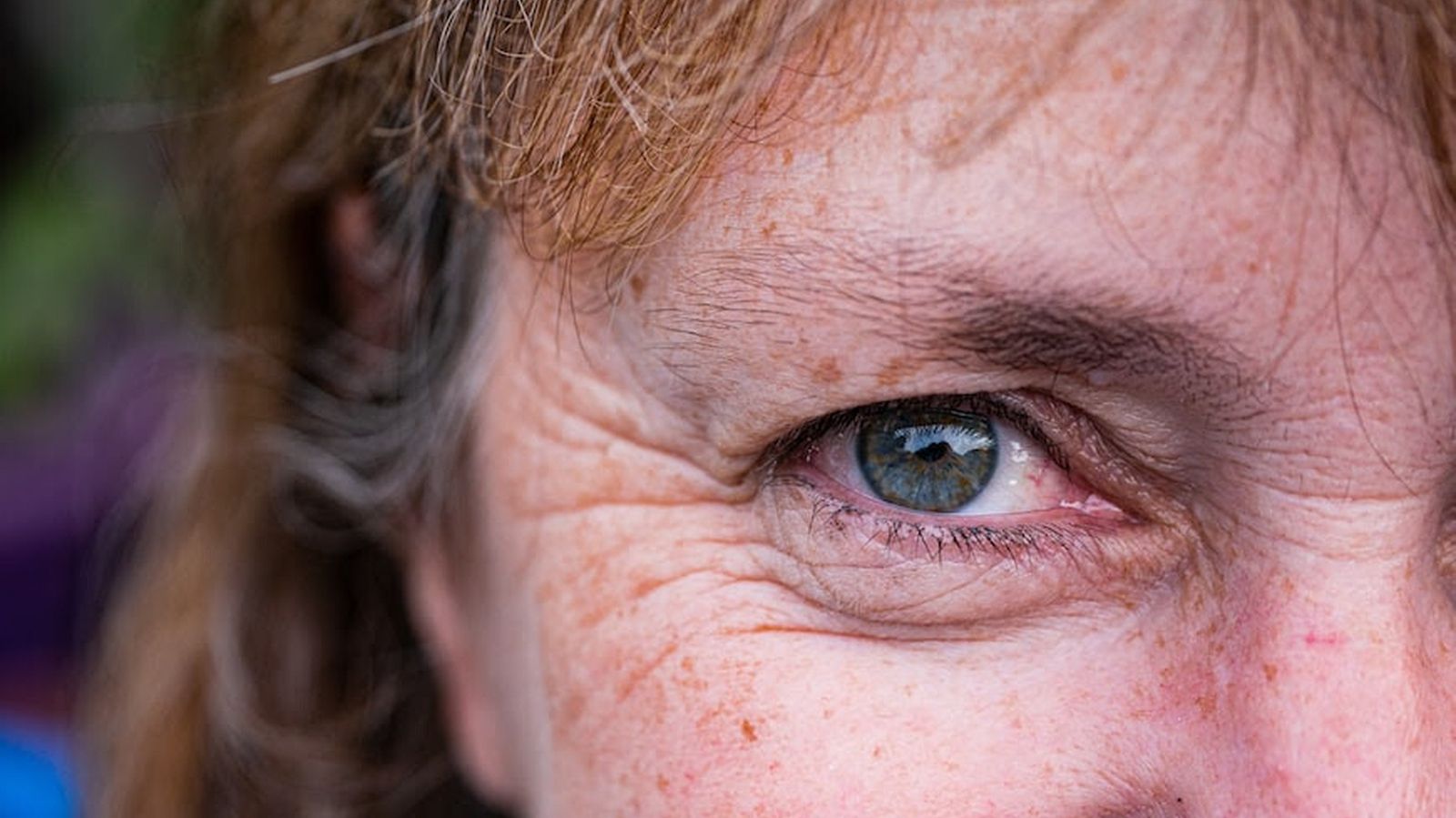 Arrugas de expresión: los 3 mejores tratamientos no invasivos para eliminarlas