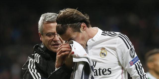 Bale solo sufre un golpe en la nariz