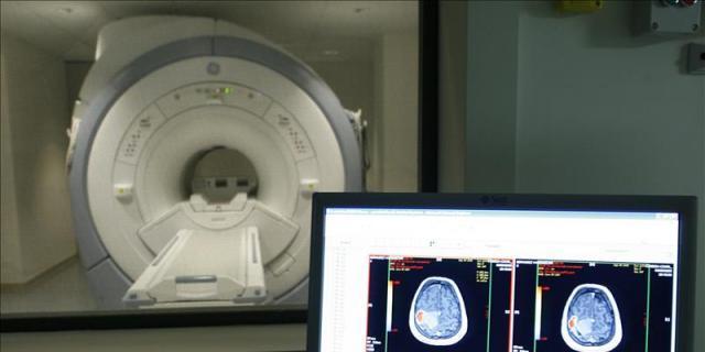 La Paz recluta voluntarios para realizar un estudio sobre el Alzheimer