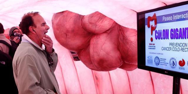 Sanidad practicará pruebas para detectar el cáncer de colon entre 50 y 69 años