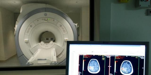 El cerebro de las afectadas de anorexia no se recupera pese al tratamiento