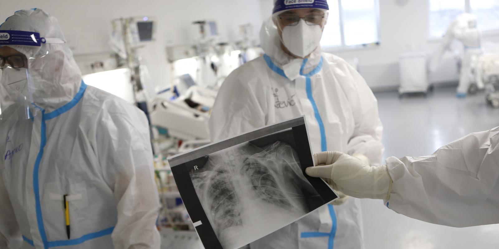 Alerta: la muerte por cáncer de pulmón en mujeres ha subido el 6,5%