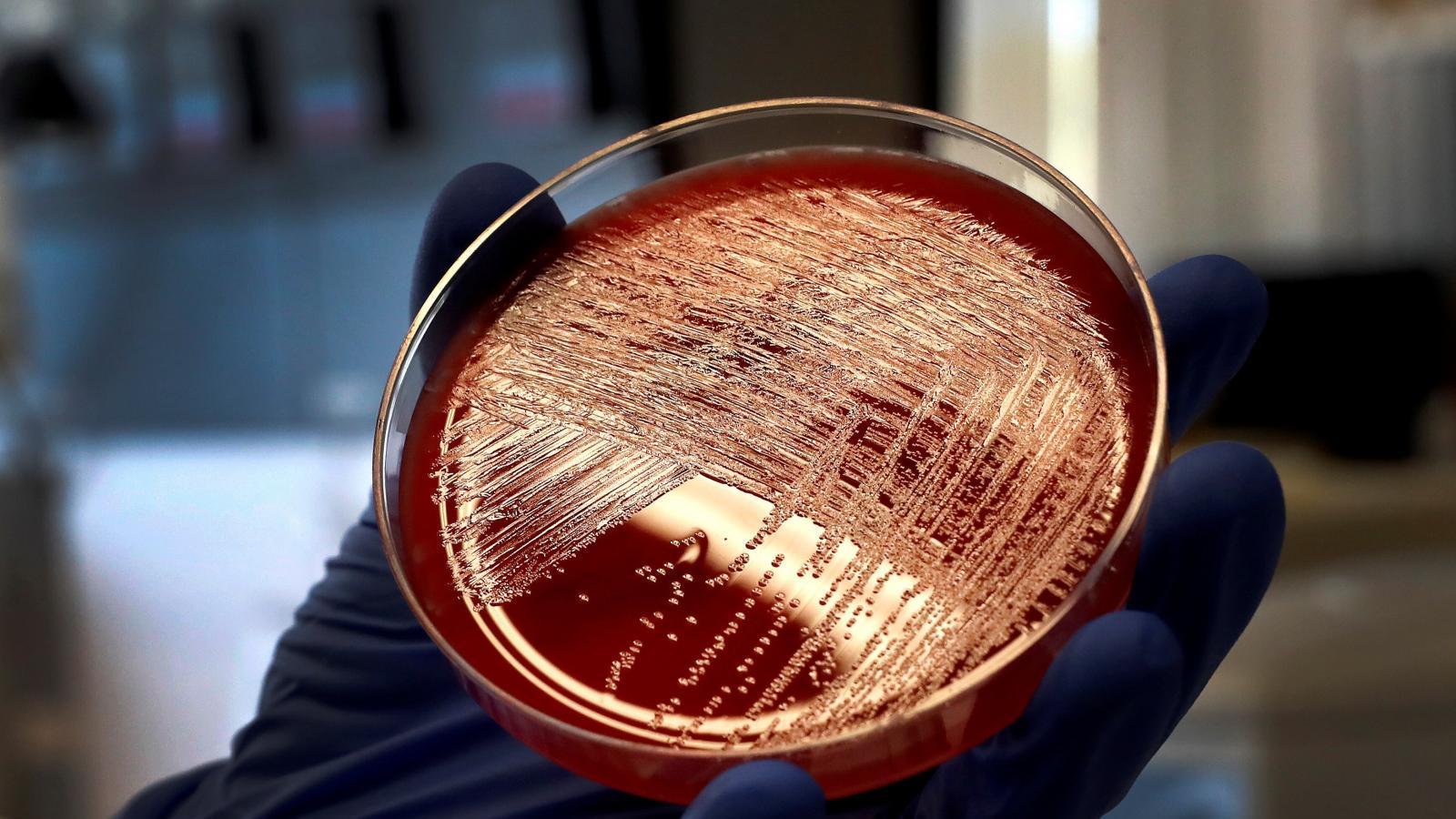 Cataluña notifica presencia de listeria en varios lotes de butifarra