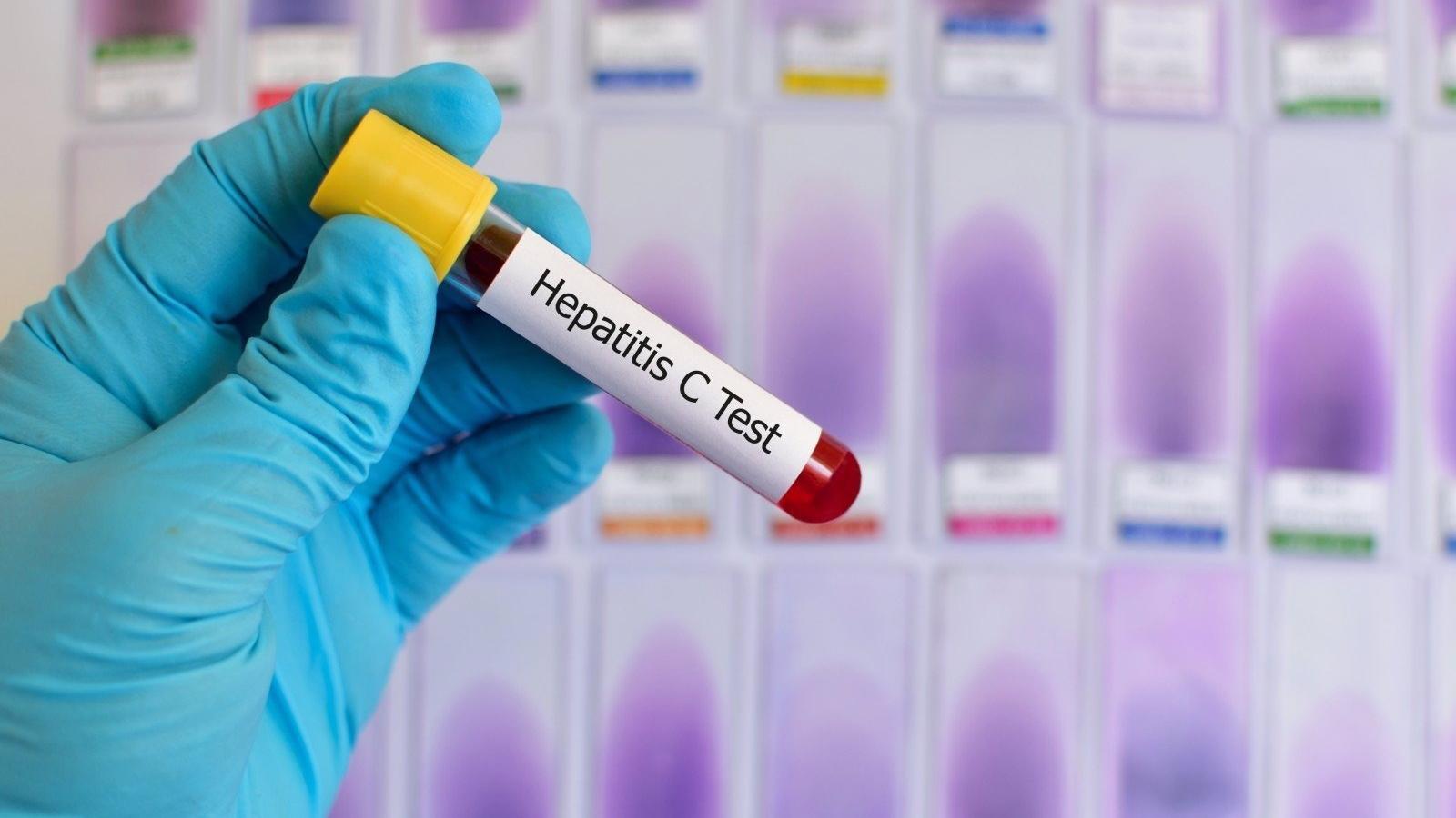 La capital se suma a '#hepCityFree' para reforzar la prevención y eliminación de la Hepatitis C