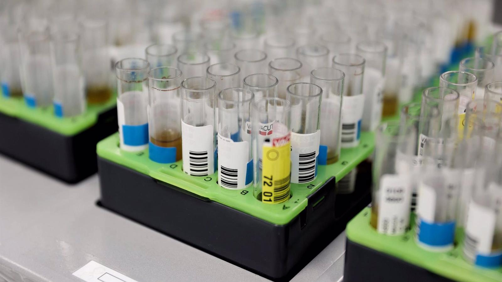 Sanidad regional contabiliza 847 casos de viruela del mono tras sumar otros 27 positivos en las últimas horas