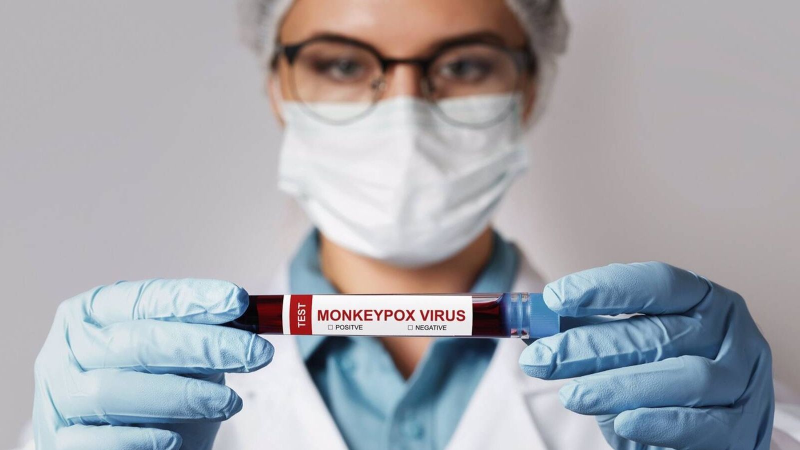 El contacto piel con piel sería la causa más probable de transmisión de la viruela del mono