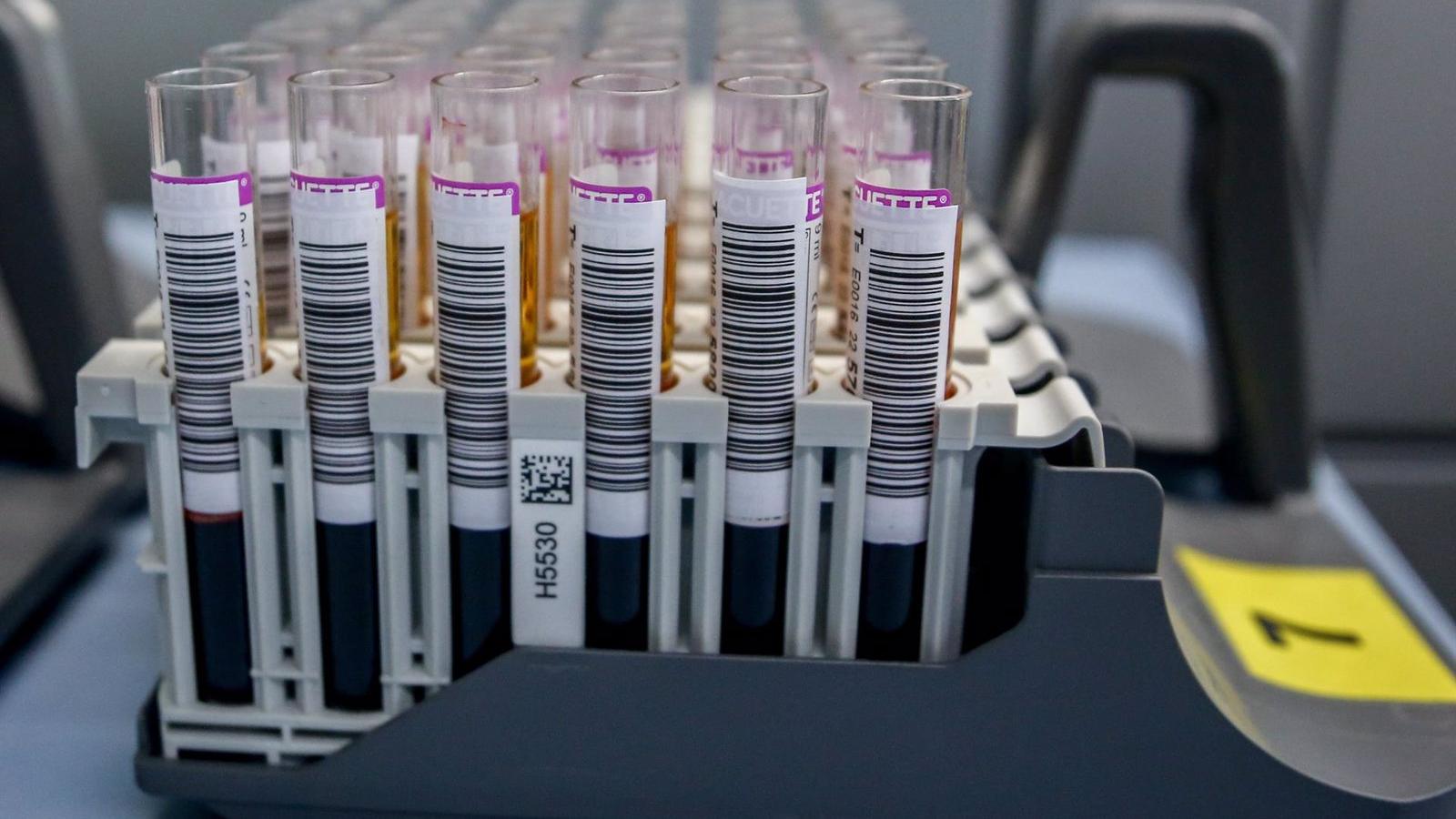 Los hospitales madrileños necesitan con urgencia donaciones de sangre de los grupos 'A+', '0+' y 'B-'