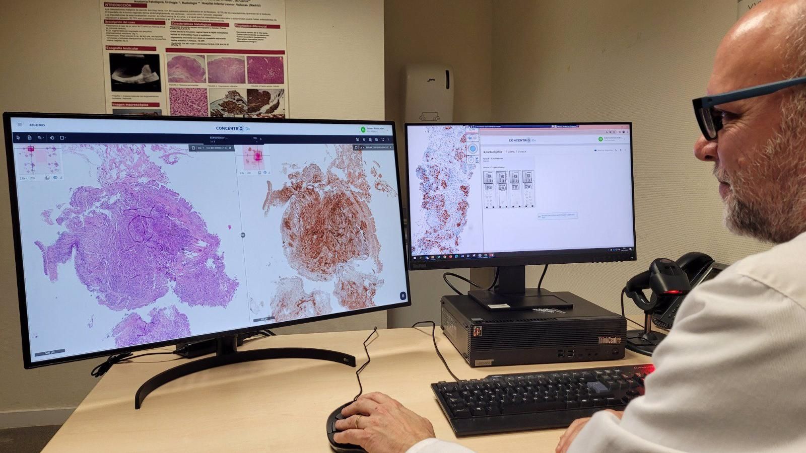 El hospital Infanta Leonor implanta un sistema de patología digital completo de mejora de diagnóstico