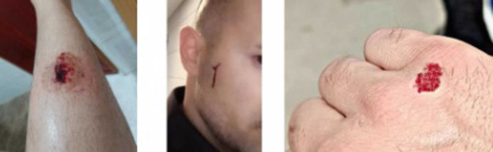 Varios policías heridos durante una detención en Fuenlabrada al fallarles la táser