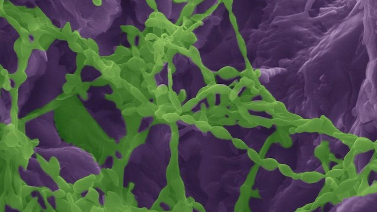 La UAM y la UCM desarrollan un sistema para predecir brotes de cianobacterias en aguas dulces
