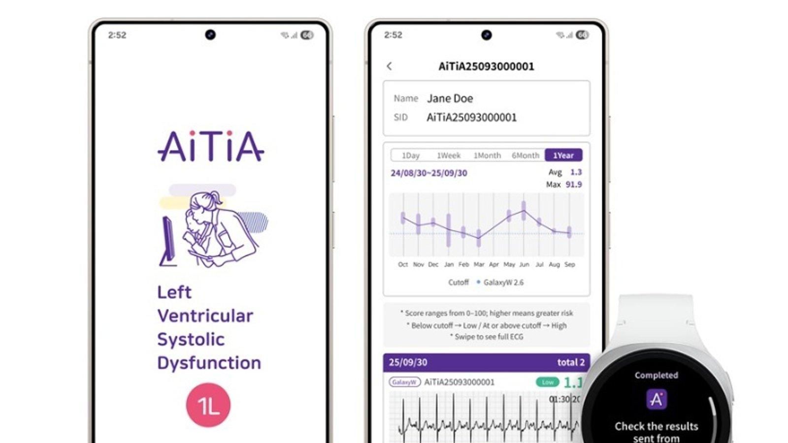 Los relojes de Samsung detectarán insuficiencia cardíaca
